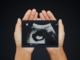 Claims that foetuses are surrounded by bacteria in the womb are incorrect – new review