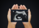 Claims that foetuses are surrounded by bacteria in the womb are incorrect – new review